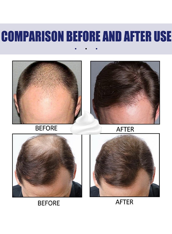 Men's Hair Regrowth Treatment Foam, For Thinning Hair, Hair Follicle, Hair Revitalizes With Topical Aerosol Revitalizes, Nurturing Scalp And Effective Hair Thickening For Men, 60G