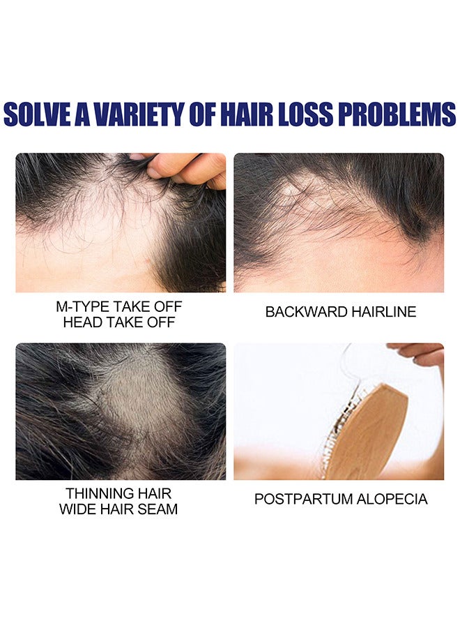 Men's Hair Regrowth Treatment Foam, For Thinning Hair, Hair Follicle, Hair Revitalizes With Topical Aerosol Revitalizes, Nurturing Scalp And Effective Hair Thickening For Men, 60G