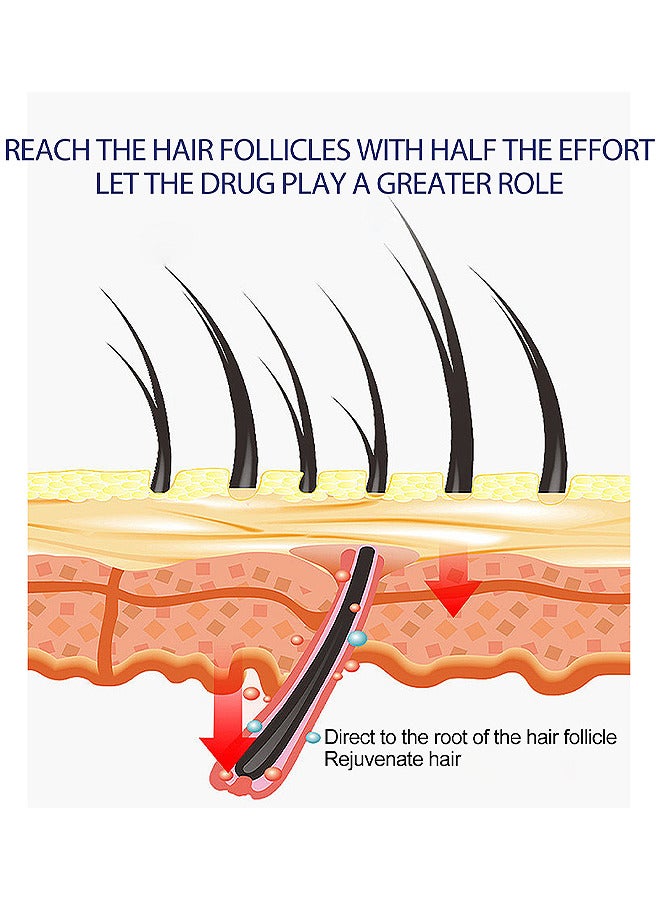 Men's Hair Regrowth Treatment Foam, For Thinning Hair, Hair Follicle, Hair Revitalizes With Topical Aerosol Revitalizes, Nurturing Scalp And Effective Hair Thickening For Men, 60G