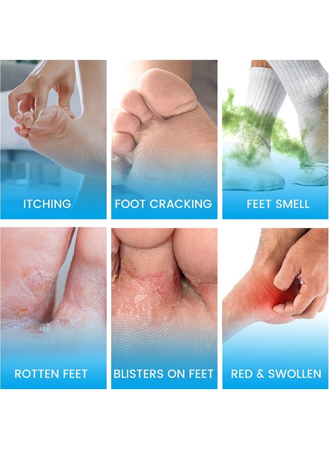 Foot Antibacterial Cream,Athlete's Foot Odor Foot Cream, Antifungal Cream, Antibacterial Cream For Athletes' Foot, Sterilization Treatment Anti-Infection Foot Care Repair 20G