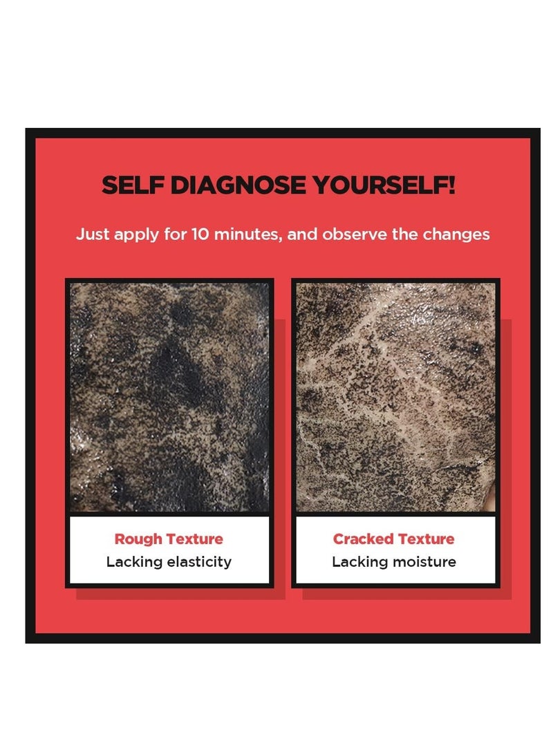 SKIN1004 Zombie Beauty Mummy Pack & Activator Kit, Wrinkles Treatment, Smoothening,Wrinkles