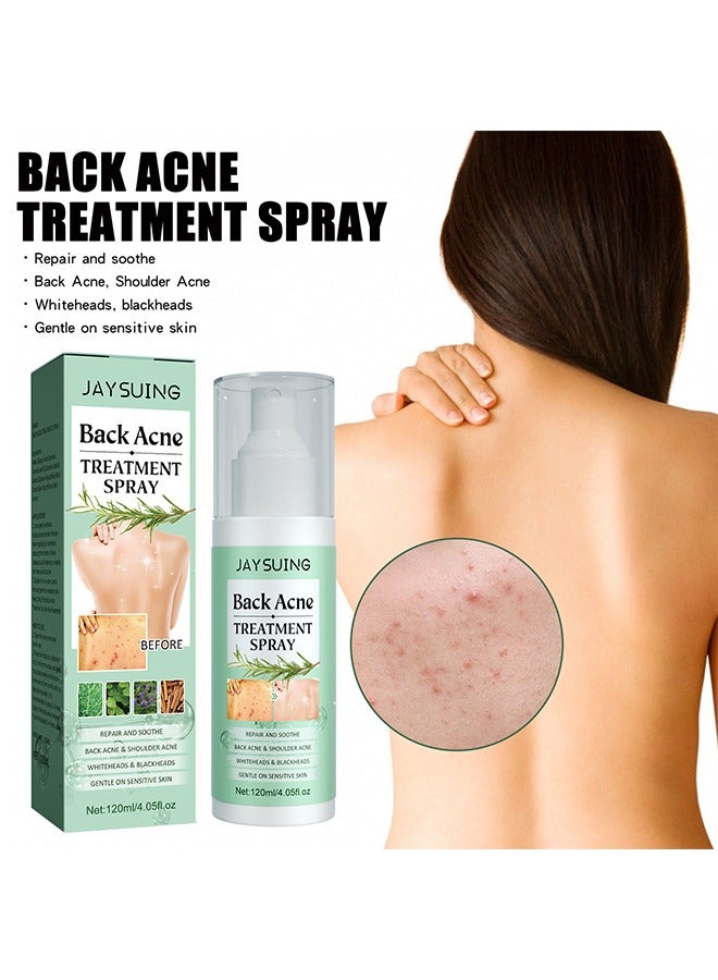 Back Acne Treatment Spray120ml -Tea Tree Oil Spray,Body Acne Treatment with Herbal Formula, Acne Treatment For Teens, Back Acne