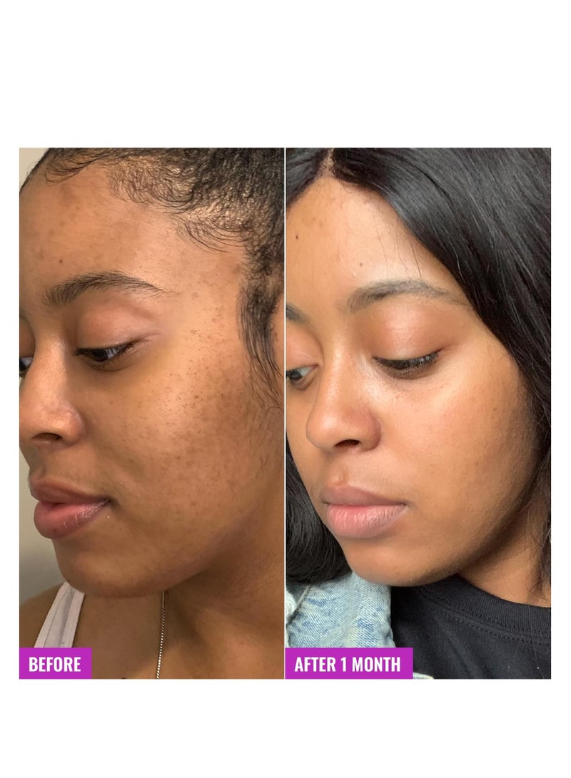 Good Molecules Glycolic Exfoliating Toner - Facial Toner and Exfoliant with Glycolic Acid, Hyaluronic Acid and Aloe to Moisturize - Skincare for Face