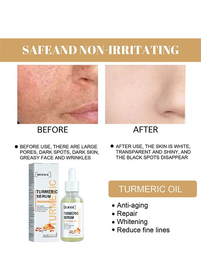 Turmeric Serum-Curcuma ​Dark Spot And Anti-Aging Turmeric Repair Face Serum, Natural Turmeric Bright Skin Dark Spot Skin Care Moisturizing Repair Serum Turmeric Oil For Face 30ml