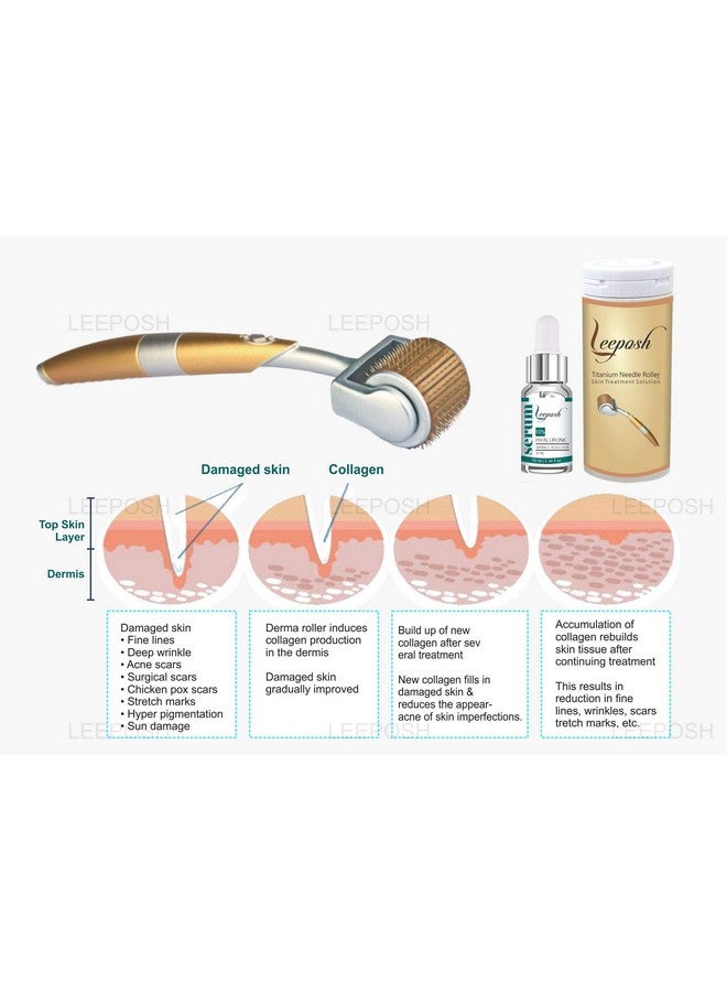 Derma Roller 1.5 Mm With Pure Hyaluronic Acid 10% Mesotherapy Serum Dermaroller Serum Treating Acne Scars Skin Hair Loss Wrinkles Scars Strechmarks