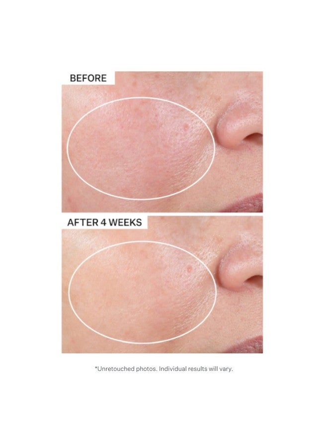 Advanced Retinol Intensive Night Moisturizer, 1.1 Fl Oz