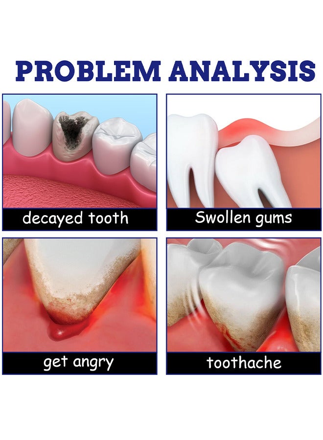 Remedies Teeth And Gums Spray, Teeth Treatment Relief Toothache Muscle Pain Sprays Remedies Teeth, Keep The Oral Environment Healthy, Effective Dental Pain Prevent