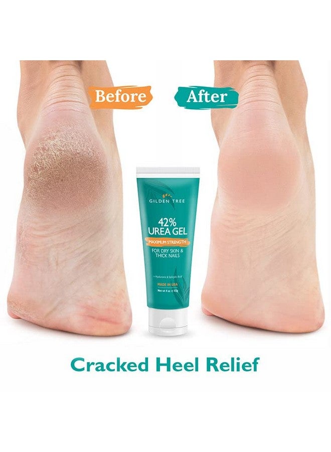 Urea Gel 42 Percent For Feet Maximum Strength Softens Cracked Heel Calluses & Thick Toenails