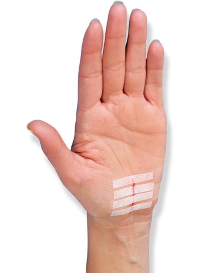 Nexcare Steri-Strip Wound Closure 30 Count