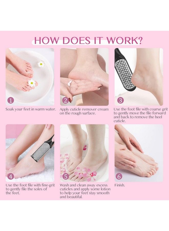 Callus Remover For Feet  180Ml609Oz Callus Remover + 2Pcs Foot Scrubber Foot File Professional Dead Skin Remover For Feet Callus Remover For Feet Pedicure Tools Foot Care Salon Home Use