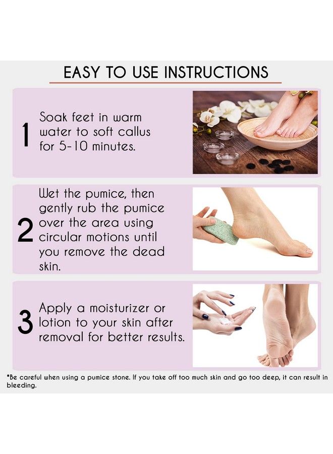 Professional Pedicure Foot Pumice Stone For Feet Skin Callus Remover And Scrubber For Dead Skins 2 Sided (Pack Of 2)