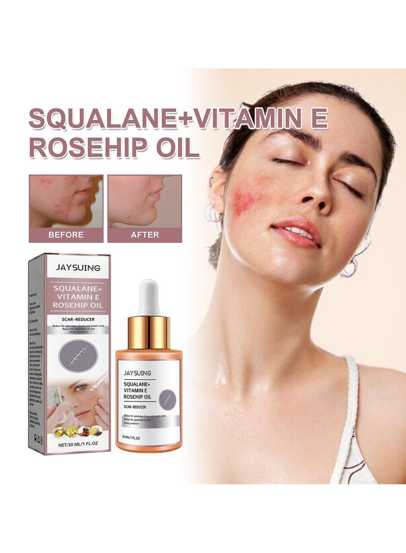 Squalane Vitamin E Rosehip Oil Fade Scars Repair Skin Essential Oil