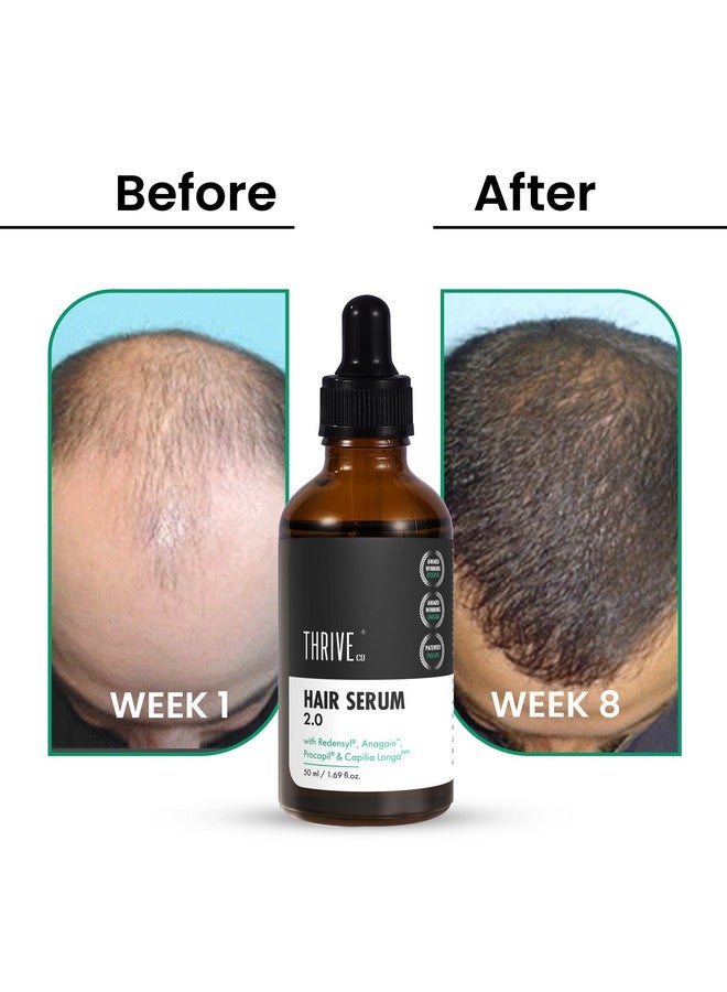 Hair Growth Serum | With Redensyl Anagain Procapil & Capilia Longa For Hair Fall Control | For Men & Women | 50Ml