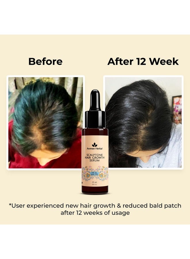 Scalptone Hair Growth Serum | Scientifically Proven Formula | Enriched With Nansyl & Green Tea Extract | For Hair Growth & Hair Fall Reduction | 25 Ml