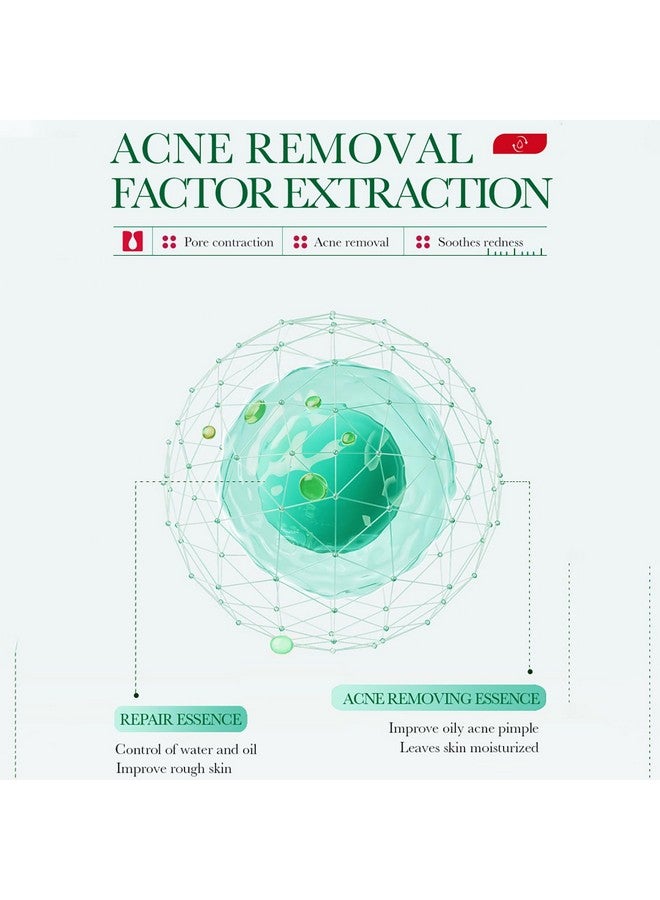 Salicylic Acid Acne Removal Essence Shrinks Pores Soothing Redness Fade Acne Marks 35Ml / 1.23Fl.Oz