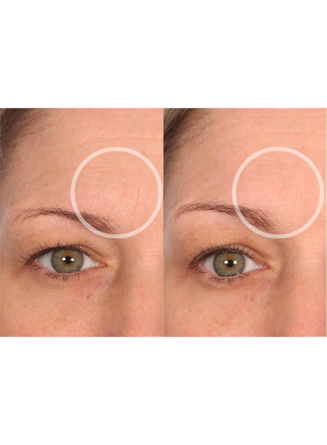 Sio Beauty Browlift Forehead Antiwrinkle Patch Expression Line Smoothing Medicalgrade Silicone For Overnight Wrinkle Reduction & Antiaging Hydration Reusable (10X)