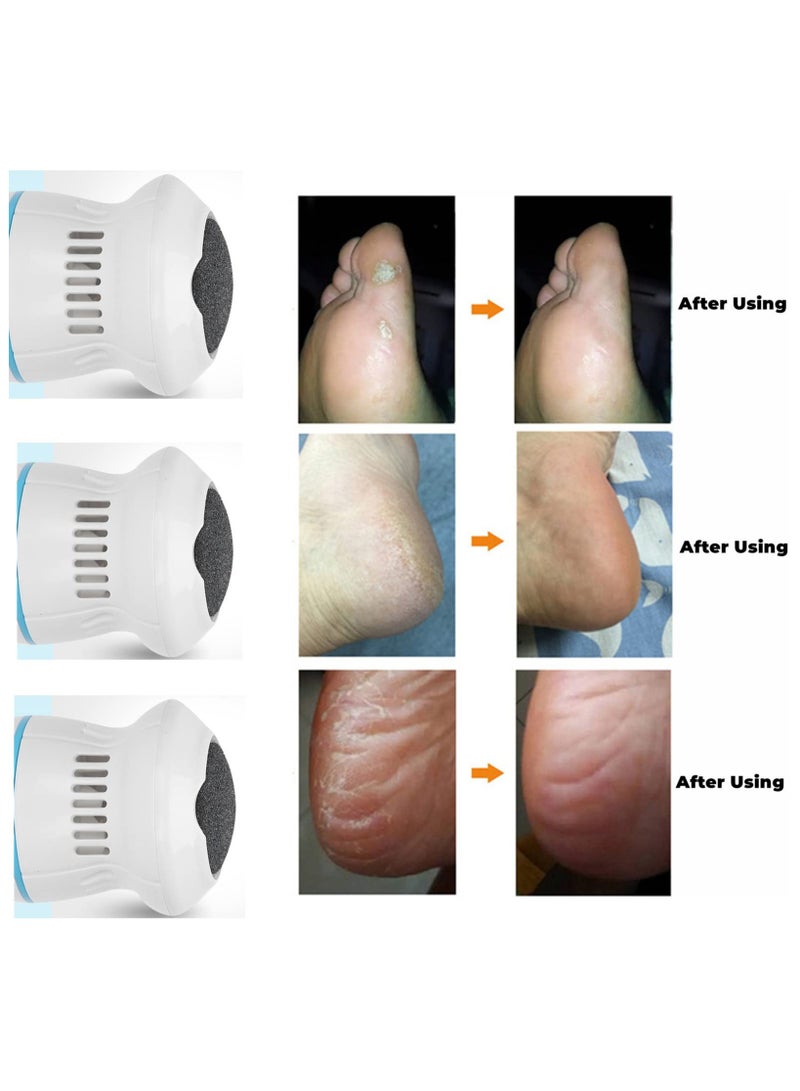 USB Rechargeable Electric Callus Remover - Portable Foot Grinder with Vacuum Adsorption, Pedicure Tools for Removing Hard Skin, Calluses, Cracked, Dry, Dead Skin - High-Powered Foot File