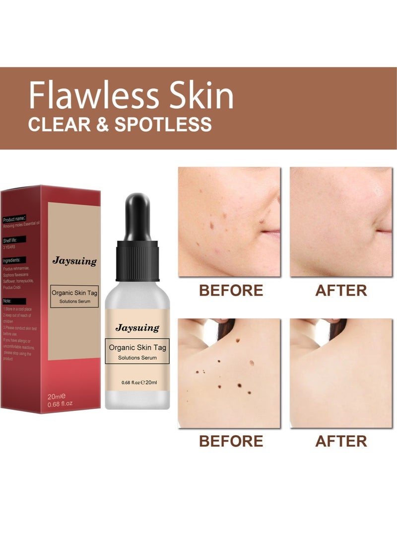 Mole Elimination Cream Black Spots Reduce Warts Skin and Flesh Mole Cleansing