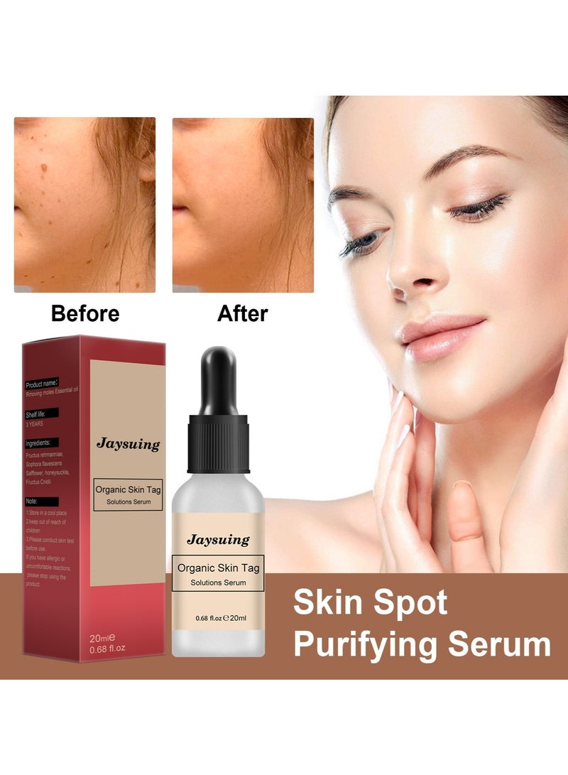 Mole Elimination Cream Black Spots Reduce Warts Skin and Flesh Mole Cleansing