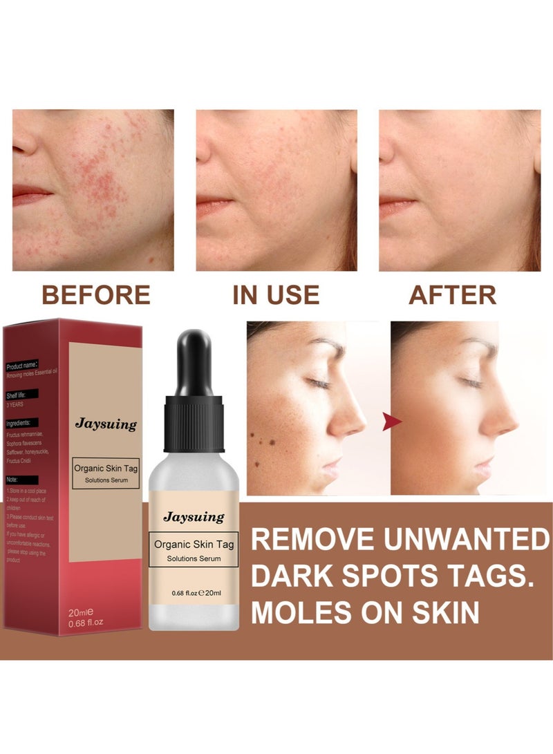 Mole Elimination Cream Black Spots Reduce Warts Skin and Flesh Mole Cleansing