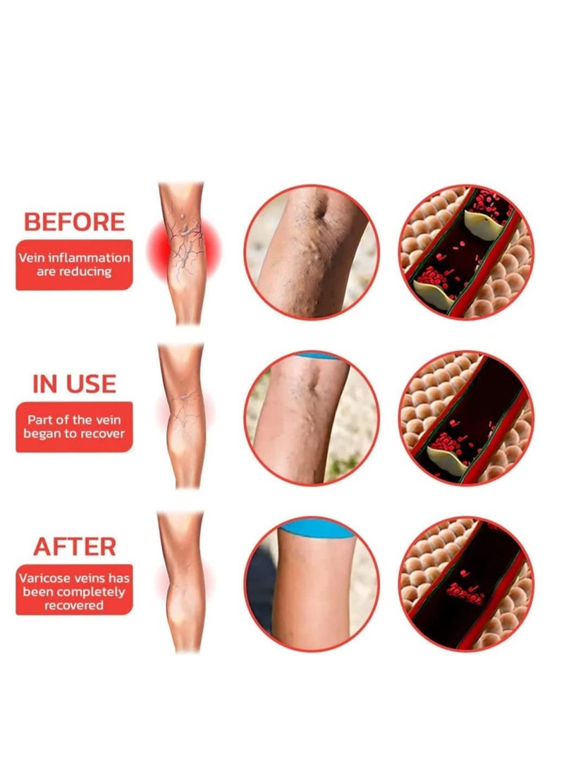 Veinless Immediate Relief Herbal Patch, Varicose Veins Treatment for Legs, Spider Veins Removal for Legs Treatment Patch (2 Box-24 Pcs)