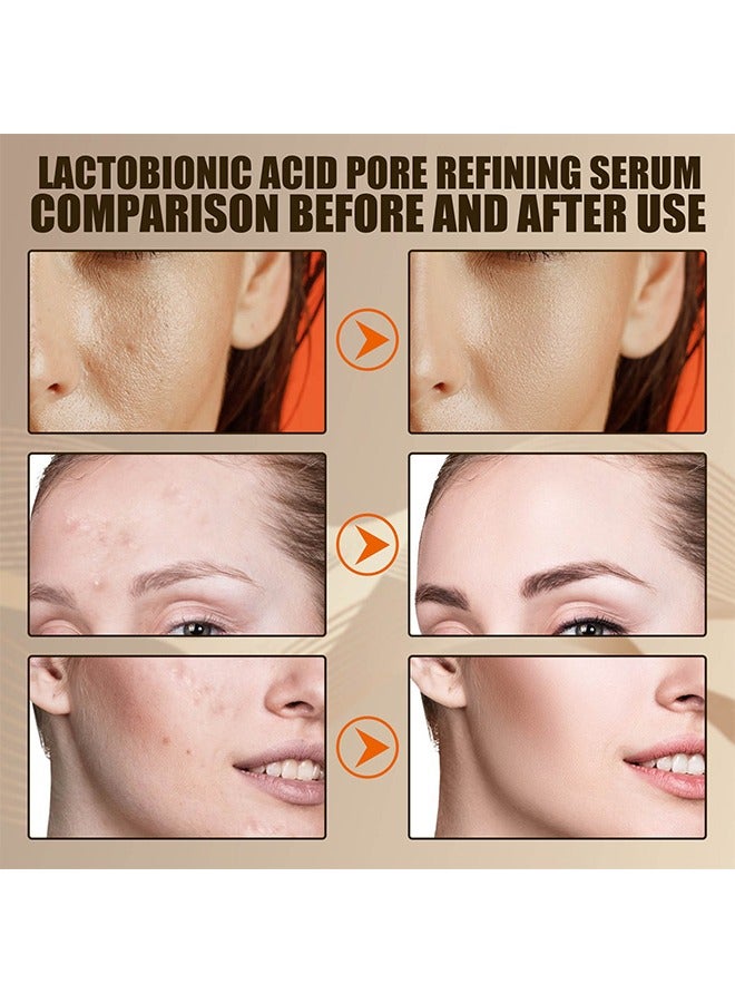 Lactobionic Acid Pore Refining Serum, Lactobionic Acid, Pores Tightening Serum, Vegan Pore Minimizer For Men And Women Regardless Of Age, 30ML