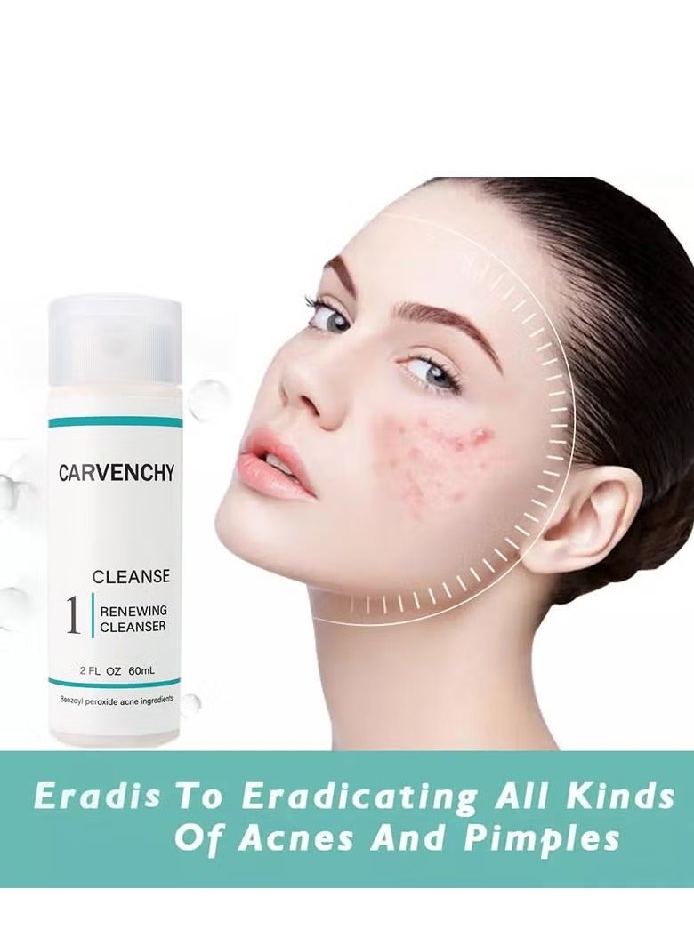 3 Step Acne Treatment 30 Day Complete Acne Skin Care Kit