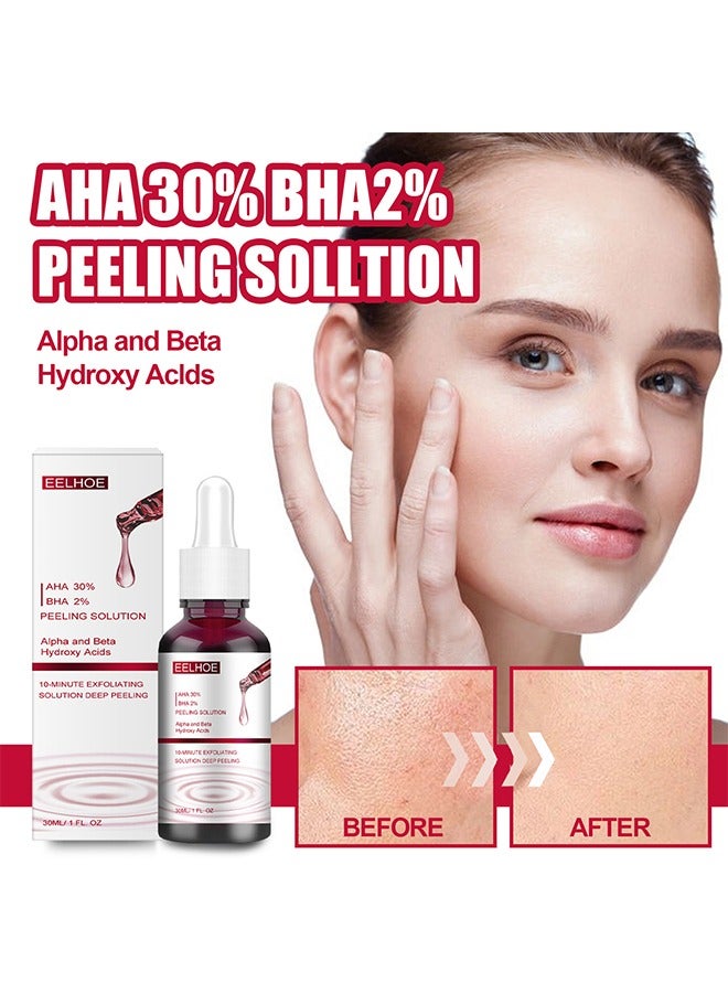 AHA30%+BHA 2% salicylic acid essence,Tone Moisturizing Repair, Powerfulexfoliation and Deepcleamsingofpores,30ml