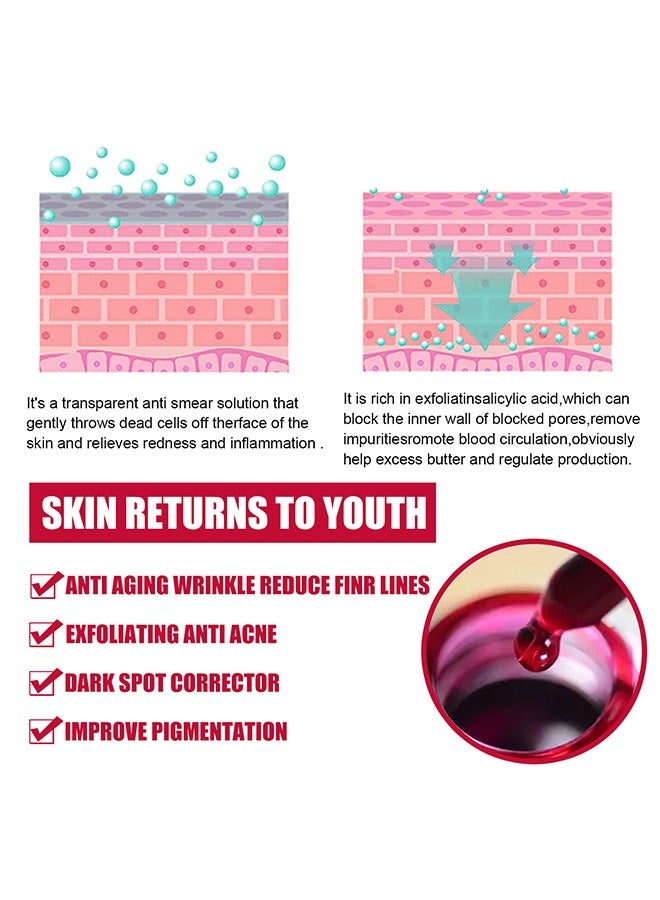 AHA30%+BHA 2% salicylic acid essence,Tone Moisturizing Repair, Powerfulexfoliation and Deepcleamsingofpores,30ml