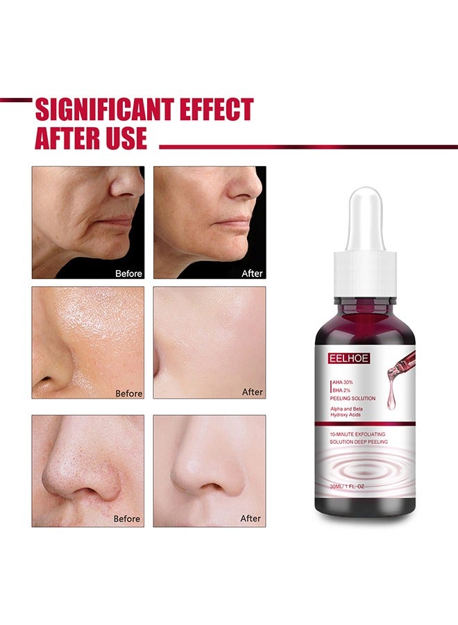 AHA30%+BHA 2% salicylic acid essence,Tone Moisturizing Repair, Powerfulexfoliation and Deepcleamsingofpores,30ml
