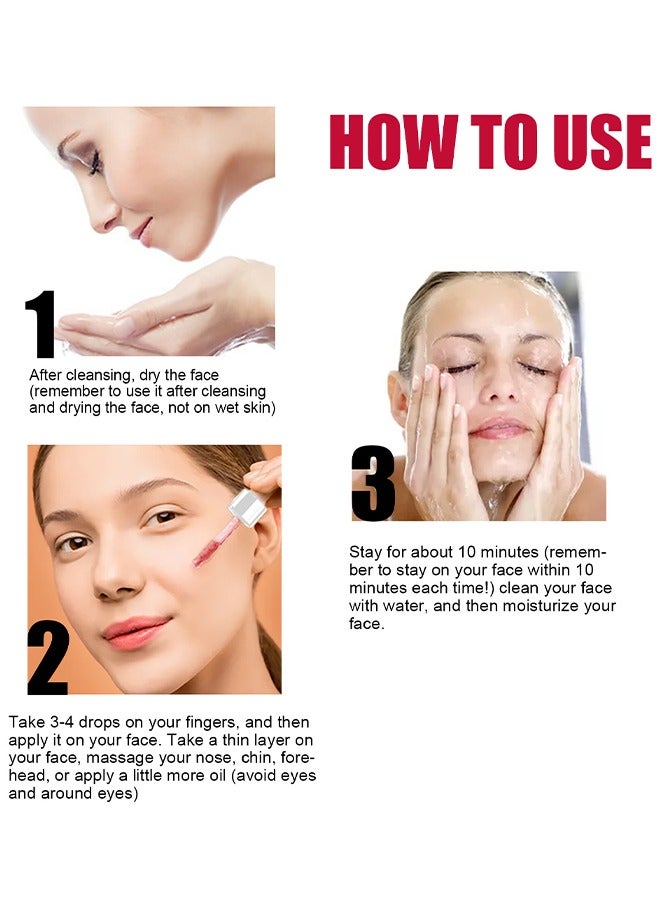 AHA30%+BHA 2% salicylic acid essence,Tone Moisturizing Repair, Powerfulexfoliation and Deepcleamsingofpores,30ml