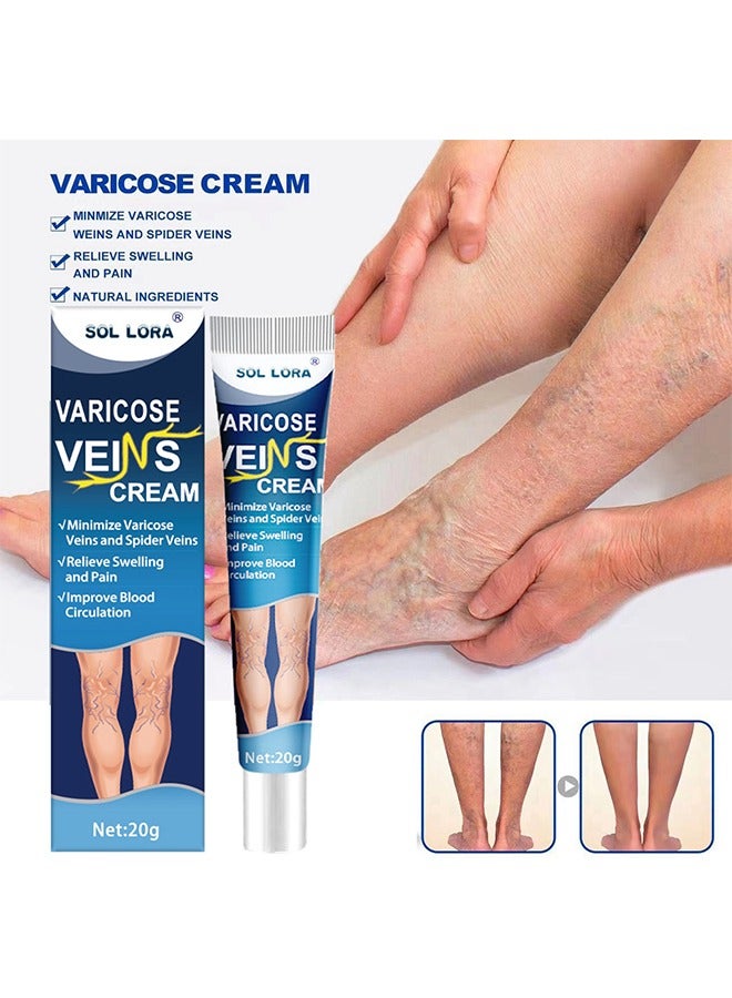 Varicose Vein Cream, Improves Blood Circulation, Reduces Spider Veins And Heaviness, Improve Blood Circulation, Tired And Heavy Legs, 20G