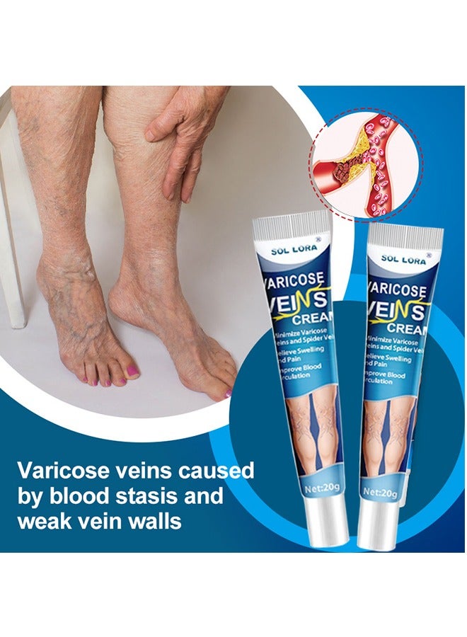 Varicose Vein Cream, Improves Blood Circulation, Reduces Spider Veins And Heaviness, Improve Blood Circulation, Tired And Heavy Legs, 20G
