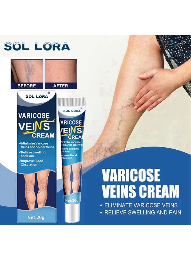 Varicose Vein Cream, Improves Blood Circulation, Reduces Spider Veins And Heaviness, Improve Blood Circulation, Tired And Heavy Legs, 20G