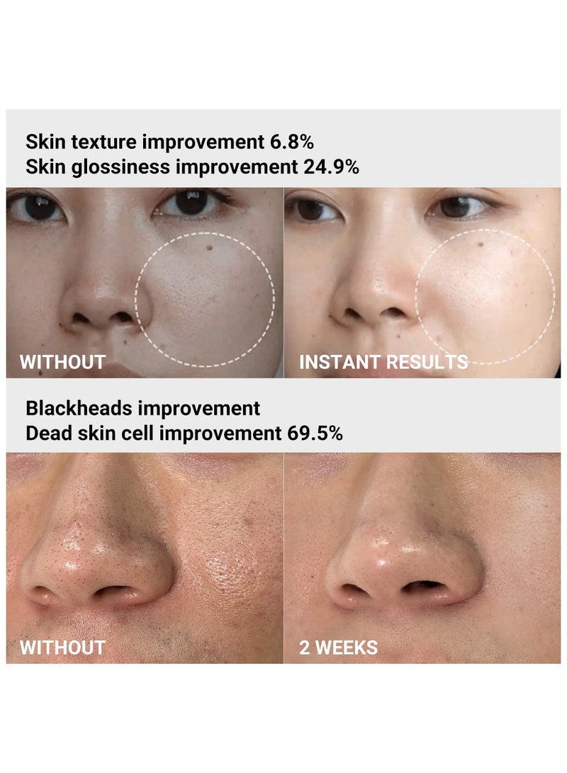 Medicube Age-R ATS Air Shot - Microneedling Skin Care Device for Pore Tightening, Enhanced Absorption, and Smoother Skin Texture - Exfoliation and Skin Rejuvenation - Korean Skincare