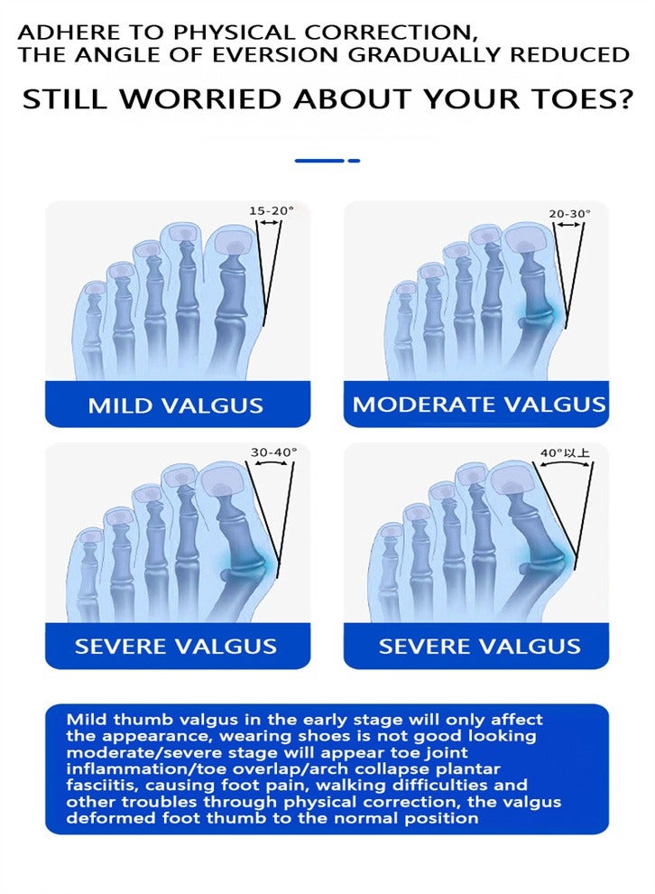 Bunion Corrector, Adjustable Knob Bunion Splint For Bunion Relief, Suitable For Left And Right Foot Toe Correction