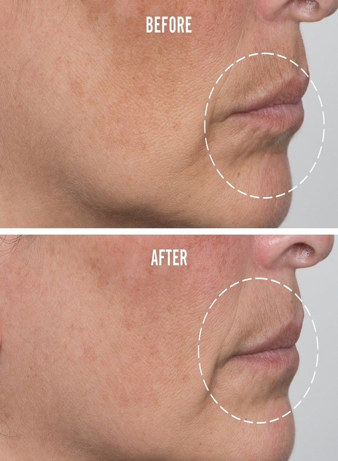 First Aid Beauty Firming Cream with Peptides Niacinamide + Collagen 50ml /1.7 FL oz