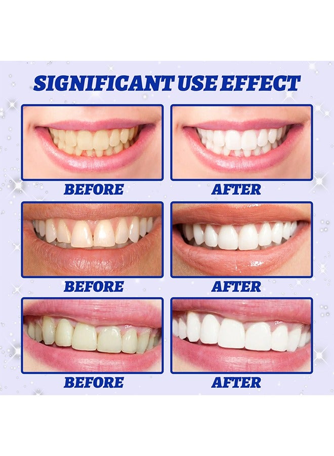 5D Teeth Whitening Strips ,3 Days Significant Whitening,Safe for Enamel,Remove Tough Stains and Easy Application 10PCS