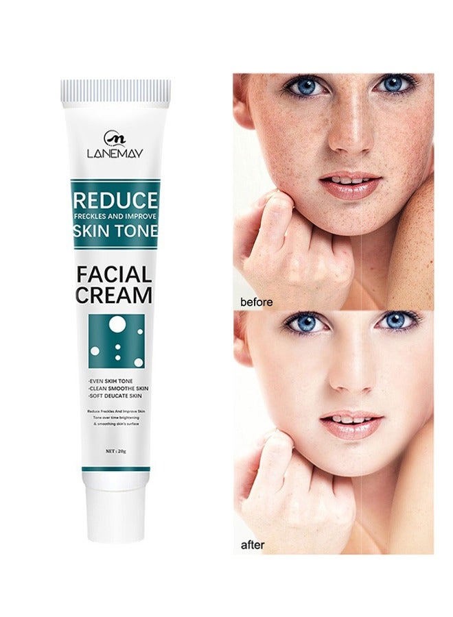 Reduce Freckles And Improve Skin Tone Facial Cream - Dark Spot Remover for Face Peeling Skin Whitening Freckle Cream Pigmentation Treatment Sun Spots Age Spots Blemish Remover Lightening Cream 20g