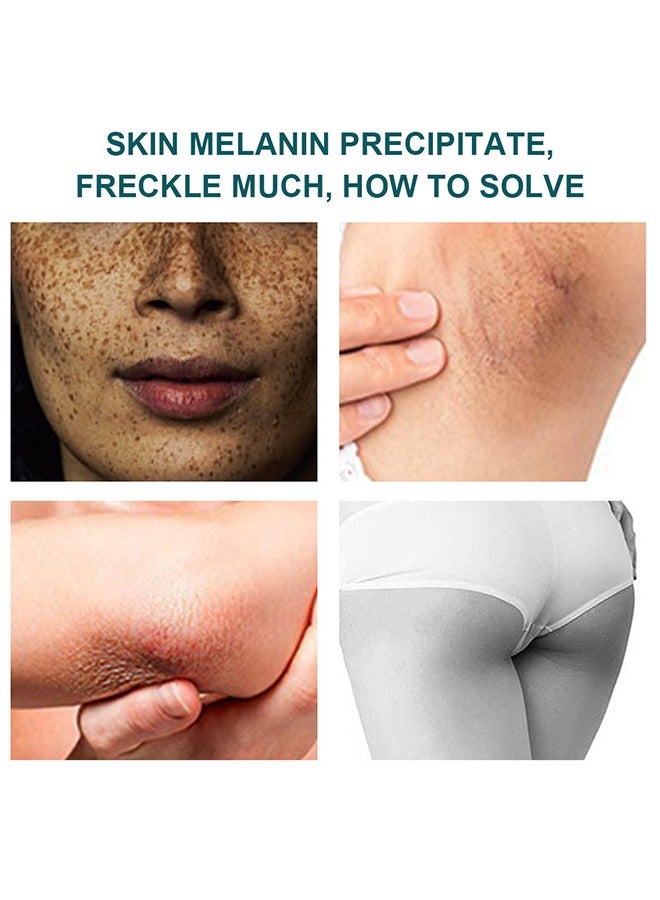 Reduce Freckles And Improve Skin Tone Facial Cream - Dark Spot Remover for Face Peeling Skin Whitening Freckle Cream Pigmentation Treatment Sun Spots Age Spots Blemish Remover Lightening Cream 20g