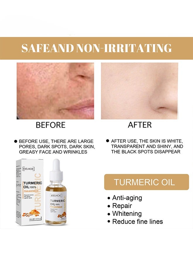 Turmeric Oil 100% Pure and Natural, Pleasant Aroma, Anti-aging, Black Spot Removing and Lighten Spots 30ml