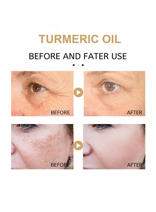 Turmeric Oil 100% Pure and Natural, Pleasant Aroma, Anti-aging, Black Spot Removing and Lighten Spots 30ml