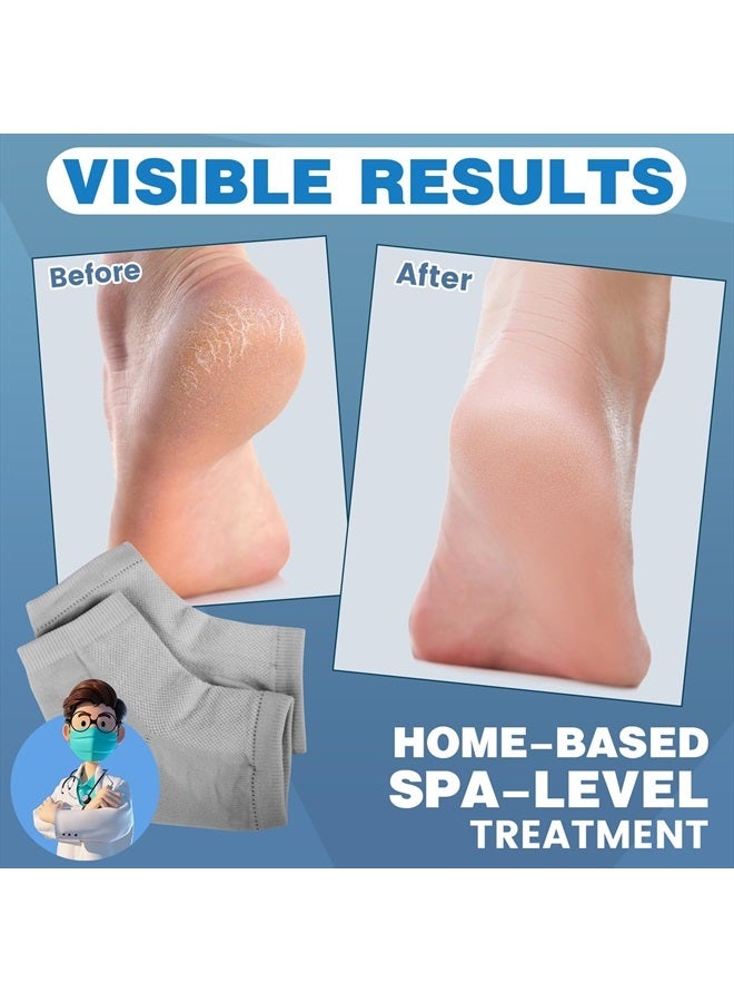 6 Pairs Moisturizing Heel Socks for Cracked Heel Treatment, Foot Care Toeless Socks to Soften and Hydrate Dry Cracked Feet Heels, Cracked Heel Repair Socks, Gel Socks for Dry Cracked Feet