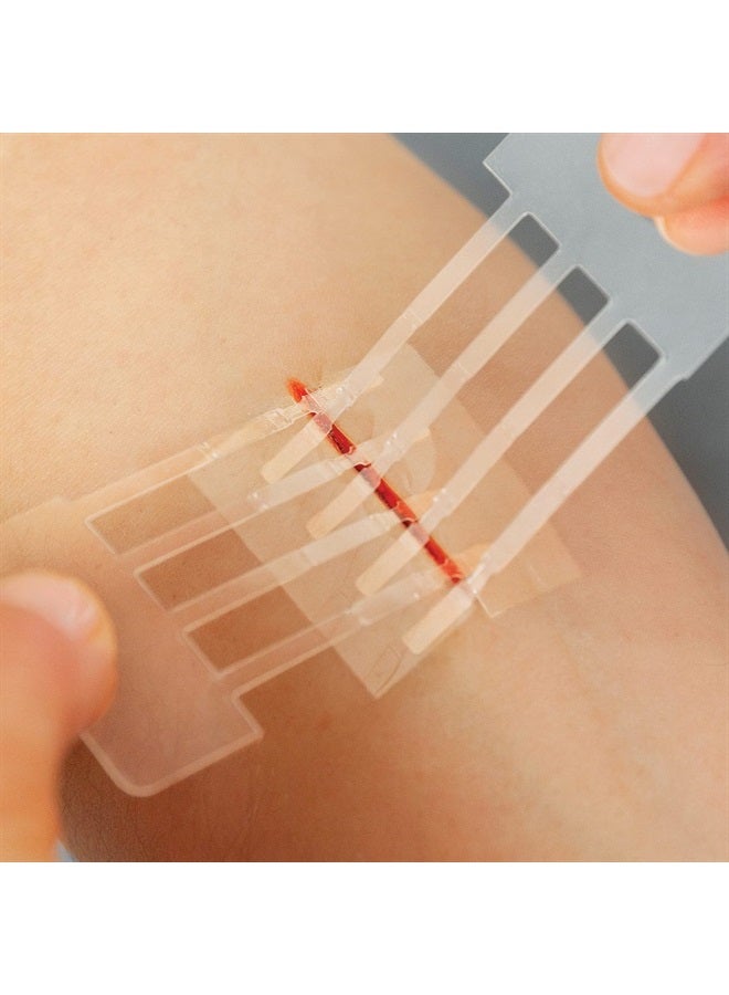 Emergency Laceration Closures - Repair Wounds Without Stitches. FDA Cleared Skin Closure Device for 3 Individual Wounds Or Combine for Total Length of 4 1/4 Inches.