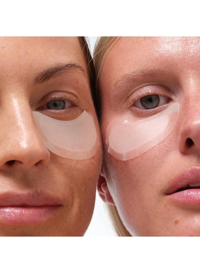 Skyn Iceland Dissolving Microneedle Under Eye Patches With 39% Hyaluronic Acid & Peptides. No Slip Eye Mask To Firm and Reduce Wrinkles & Fine Lines, 1 Pair