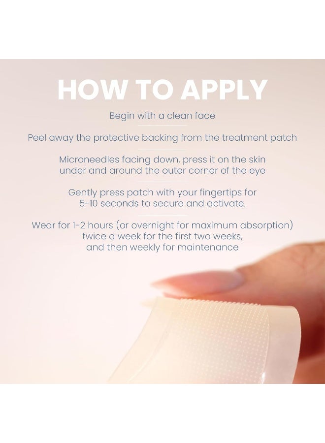 Skyn Iceland Dissolving Microneedle Under Eye Patches With 39% Hyaluronic Acid & Peptides. No Slip Eye Mask To Firm and Reduce Wrinkles & Fine Lines, 1 Pair