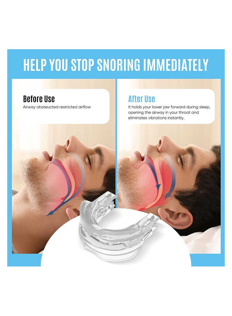 Stop Snoring Mask, Stop Snoring Device, Help Stop Snoring, Reduce Snoring Solution, Comfortable, Adjustable, Suitable for Men/Women. Allow people to get a good and restful night's sleep.