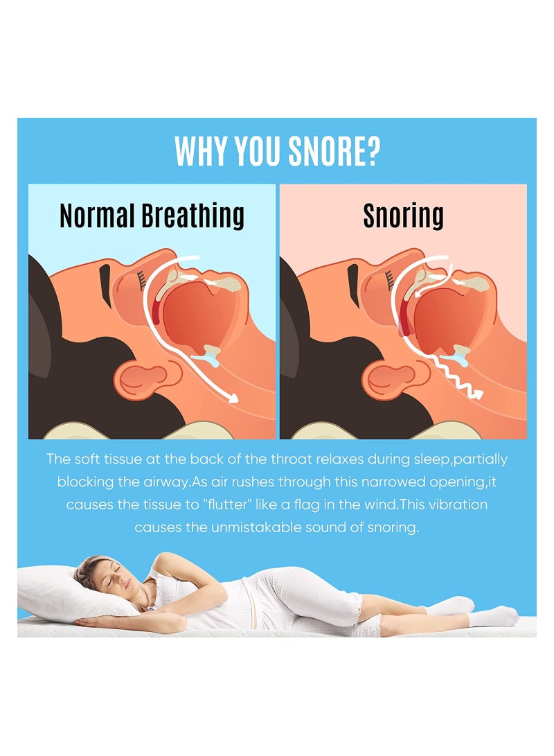 Stop Snoring Mask, Stop Snoring Device, Help Stop Snoring, Reduce Snoring Solution, Comfortable, Adjustable, Suitable for Men/Women. Allow people to get a good and restful night's sleep.