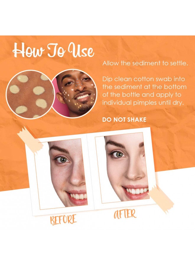 Bye Bye Blemish Dark Spot Lotion Vitamin C | Assists with Drying Blemishes And Brightening Skin | Fast Acting Solution | 1 Fl. Oz.