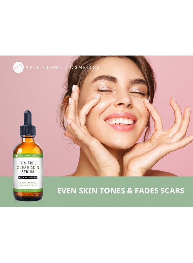 Tea Tree Serum for Face and Acne Prone Skin (1oz) by Kate Blanc Cosmetics. Tea Tree Oil Face Serum to Fight Acne Scars, Pimples, Dark Spots. Promotes Clear Skin for Teens